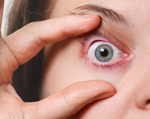 What does alcohol do to your eyes?
