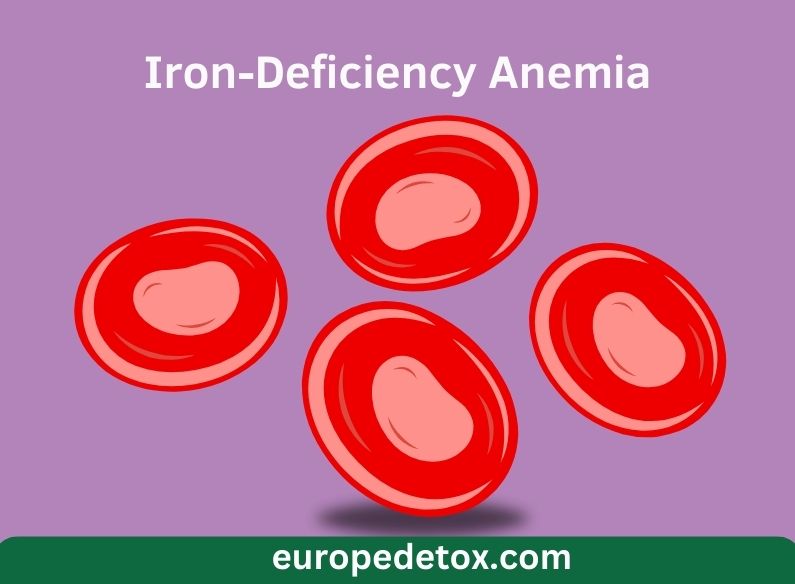 Iron-Deficiency Anemia